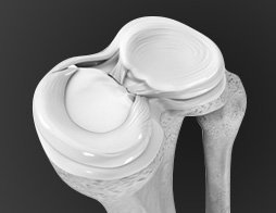 Meniscus Preservation